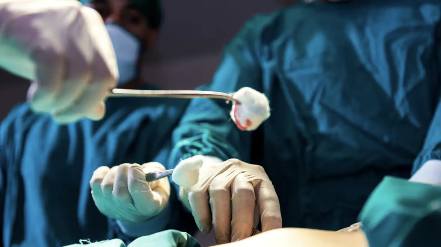 Primera neurocirugía exitosa en el Hospital de San Pedro marca un hito en la salud del interior