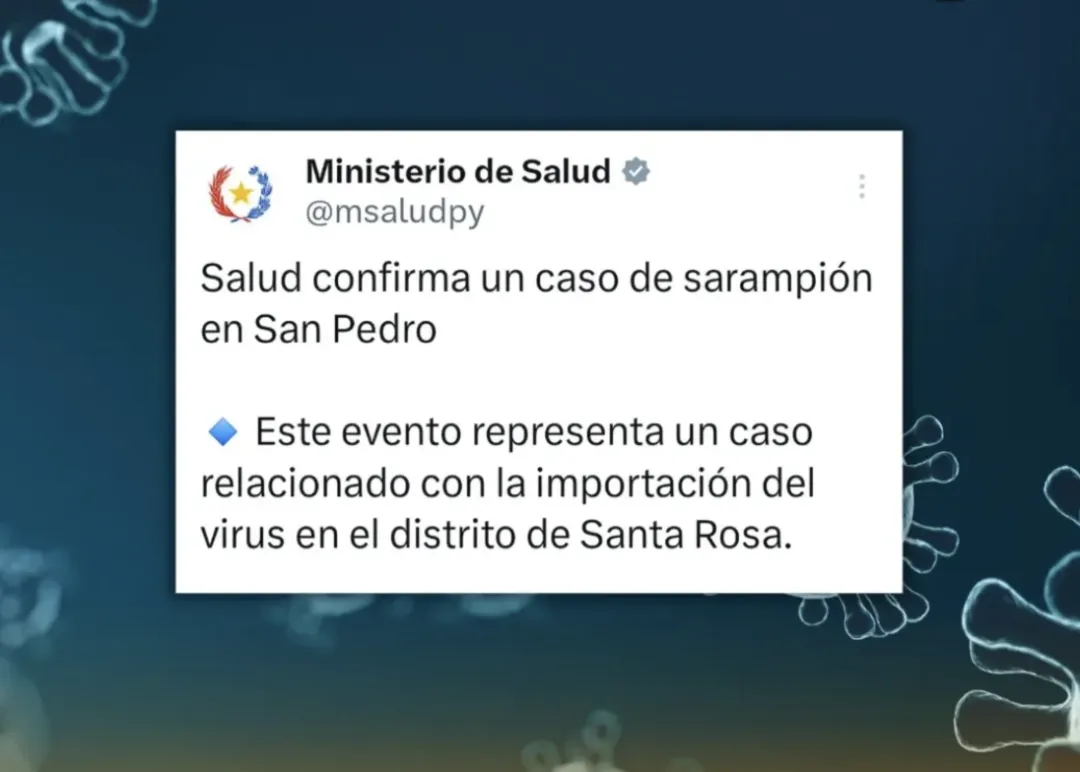 Confirman un caso de sarampión en un niño de cinco años en San Pedro