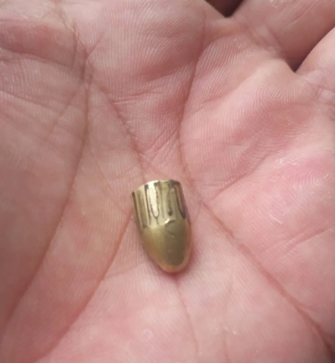 Insólito caso en Rincon’i: mujer resulta herida mientras dormía, presuntamente por una bala perdida