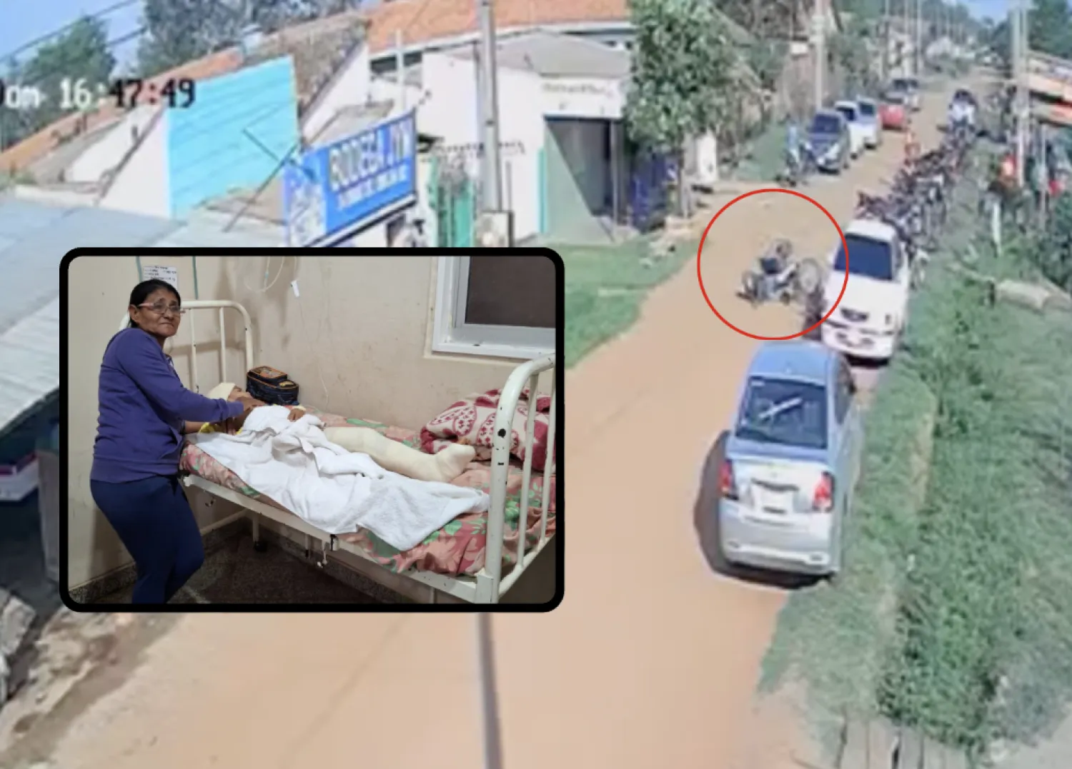 Niño de 5 años fue embestido por motociclista que hacía piruetas en Concepción