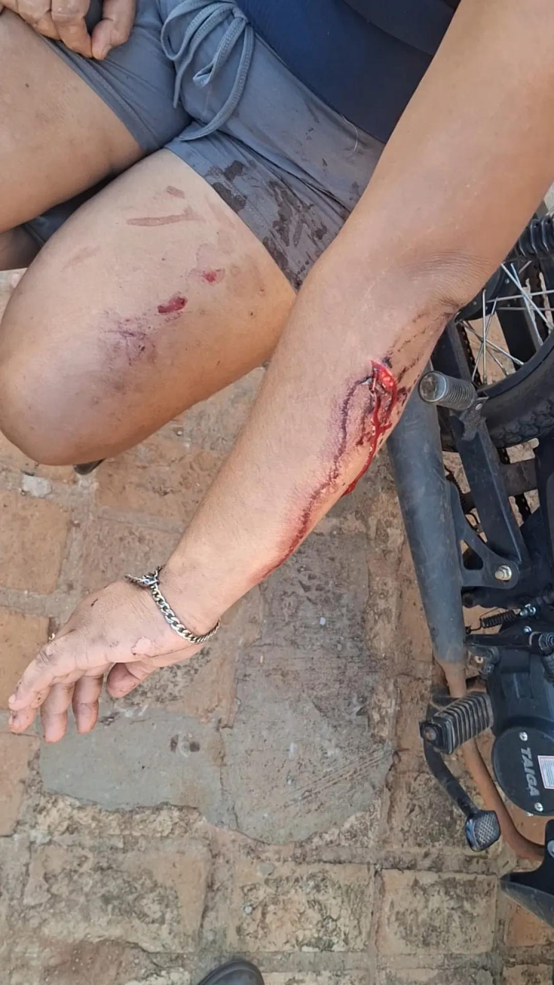 Pelea entre adictos por drogas en Calaverita