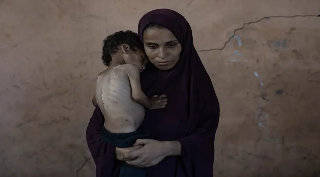 Hambruna en Gaza: ya son 10 los niños muertos por desnutrición en las últimas 24 horas