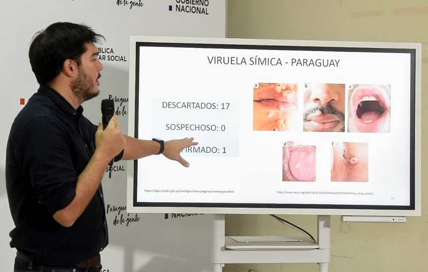 Salud Pública informó que casos positivos de viruela símica deben aislarse 21 días