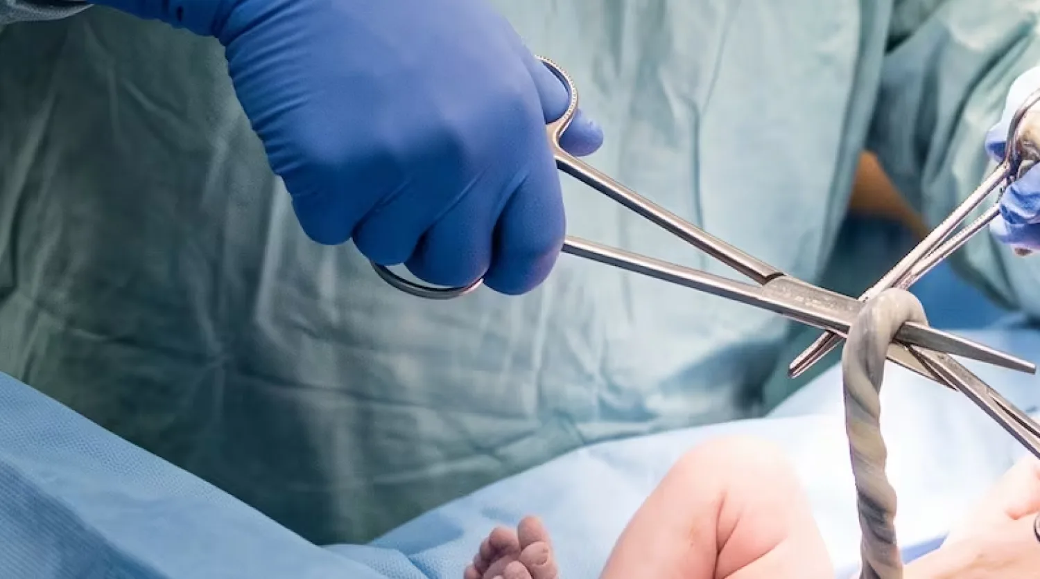 Células madre del cordón umbilical, una fuente para tratar enfermedades
