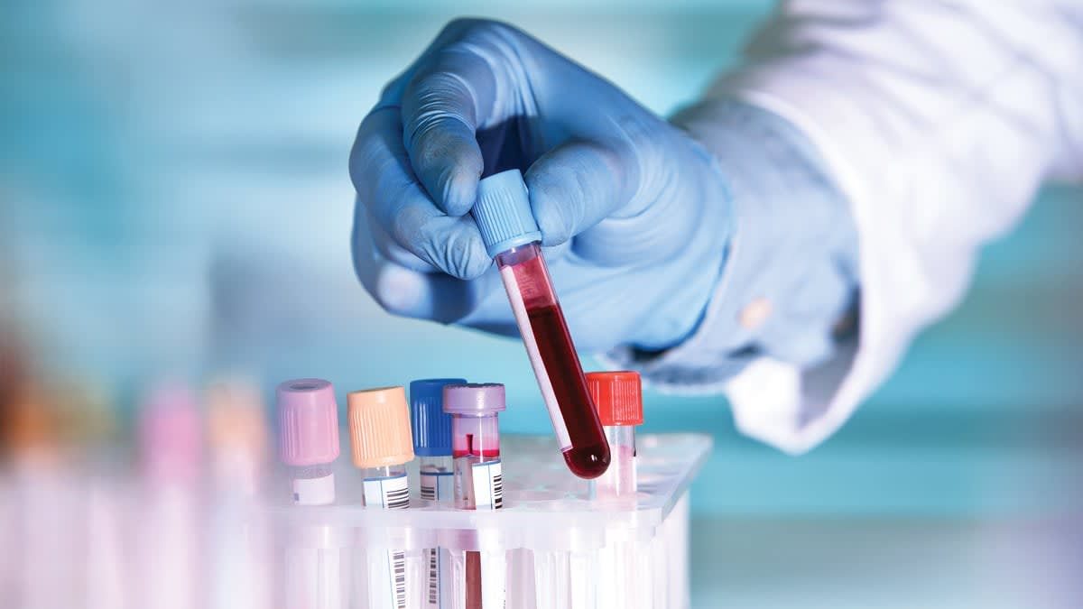 La importancia del análisis de sangre anual para la detección temprana de enfermedades