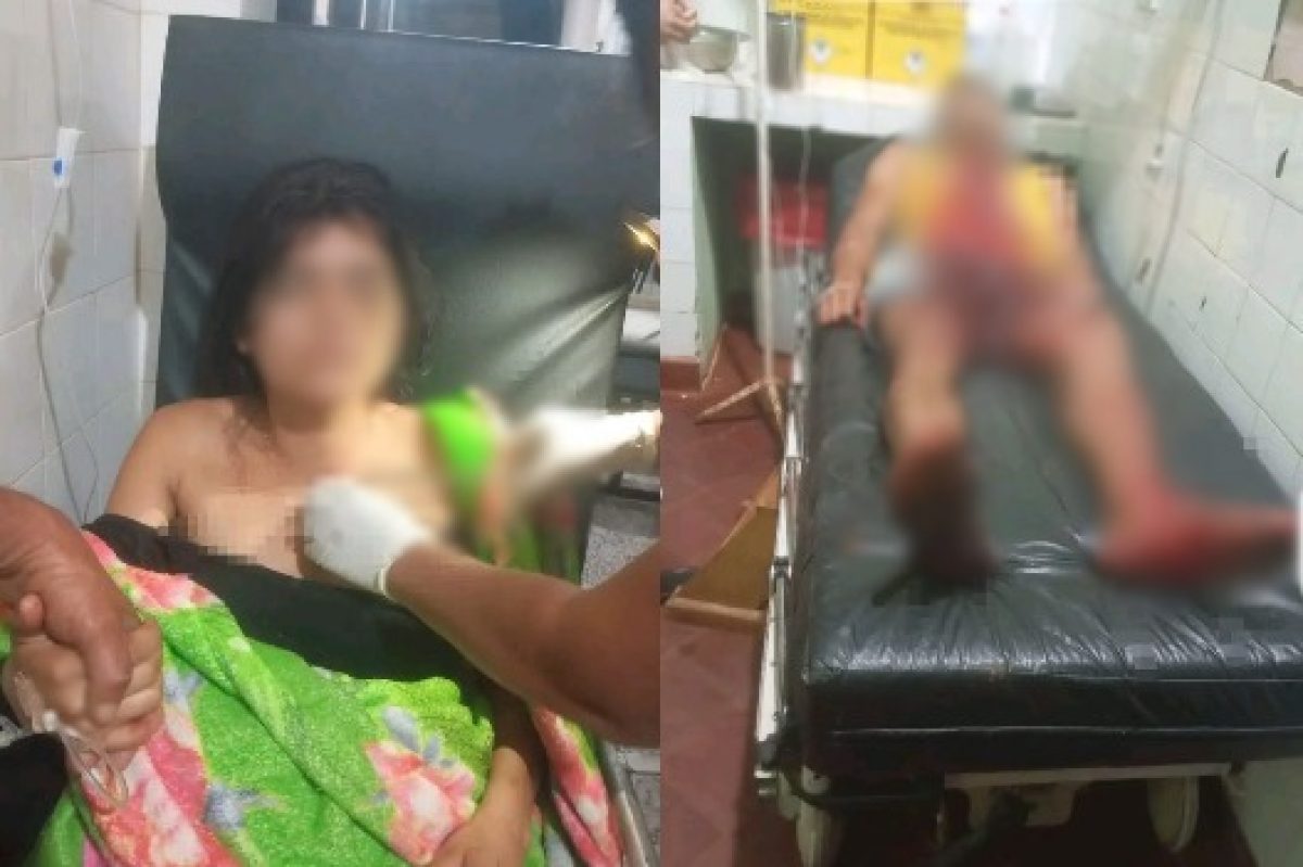 Presunto Intento de Feminicidio: Joven fue herida con un machete y su pareja terminó gravemente lesionado